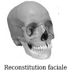 reconstitution faciale